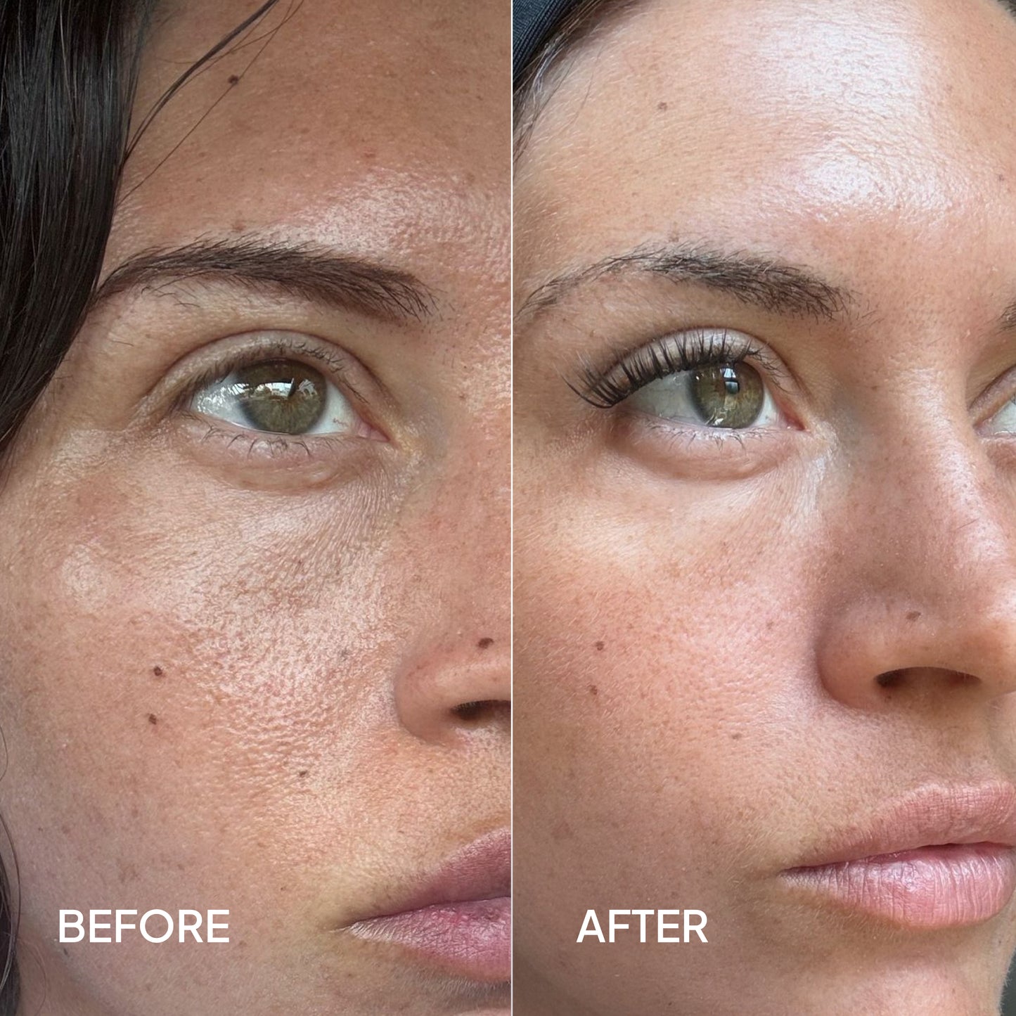 Skin texture before and after using GLOW peptide serum